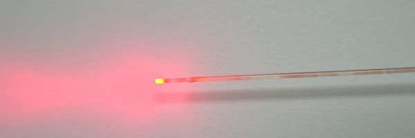 Lazerle varis tedavisinde kullanılan lazerin ucu 