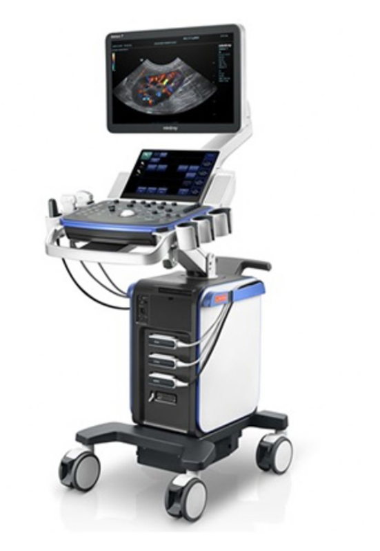 renkli doppler ultrason cihazı