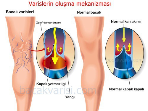 varislerin oluşumu